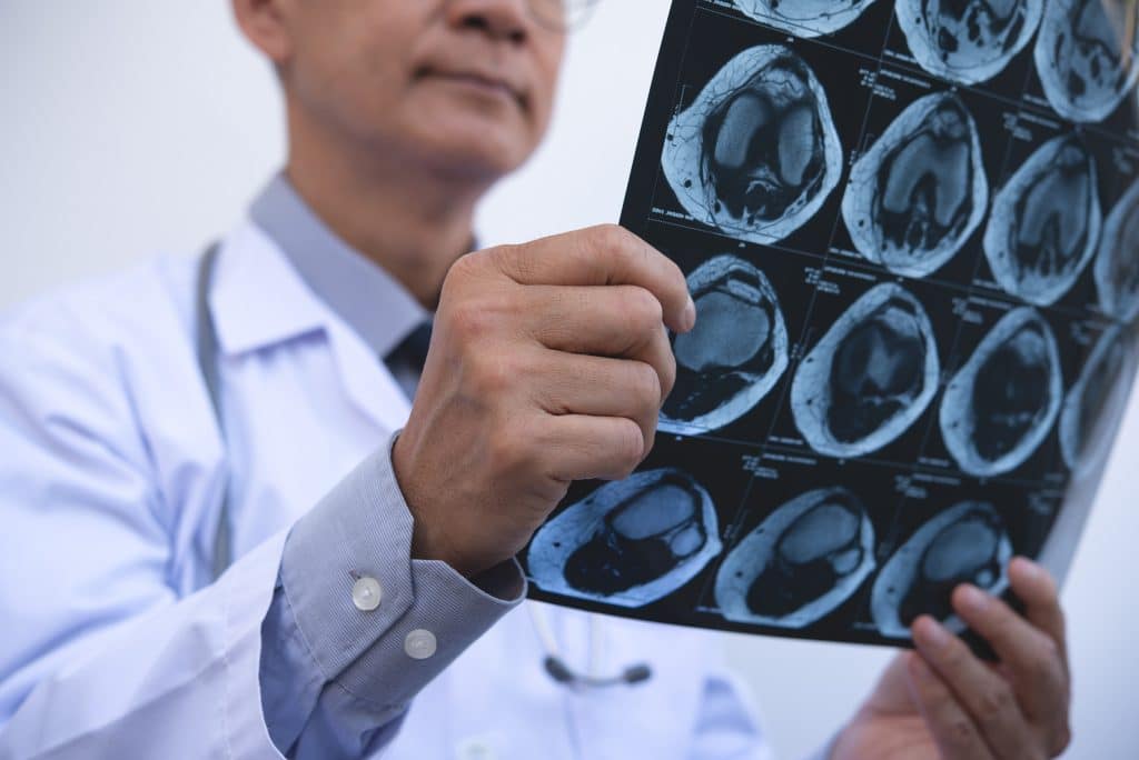 Doctor examining brain scan images to support early detection through radiology
